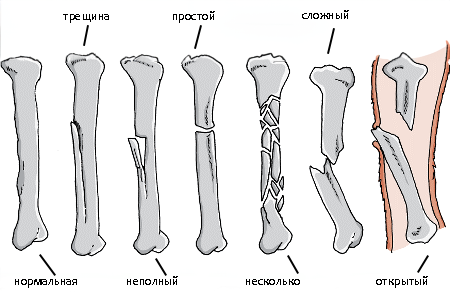 Заболевания костей у собак2.png Заболевания костей у собак2.png